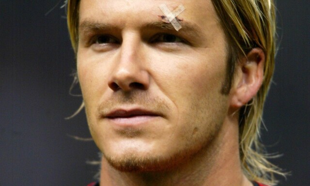 File photo dated 19/02/2003 of A plaster visible over the left eyebrow of Manchester United mid-fielder David Beckham.